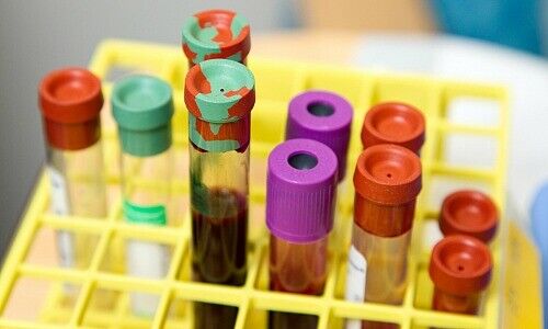 (Bild: NCI, Unsplash)