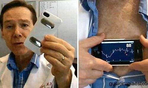 Mobile Herzüberwachung